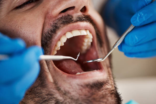 Best Emergency Tooth Extraction in Forest City, NC