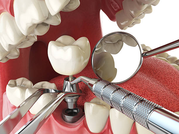 Best Pediatric Emergency Dentist in Forest City, NC